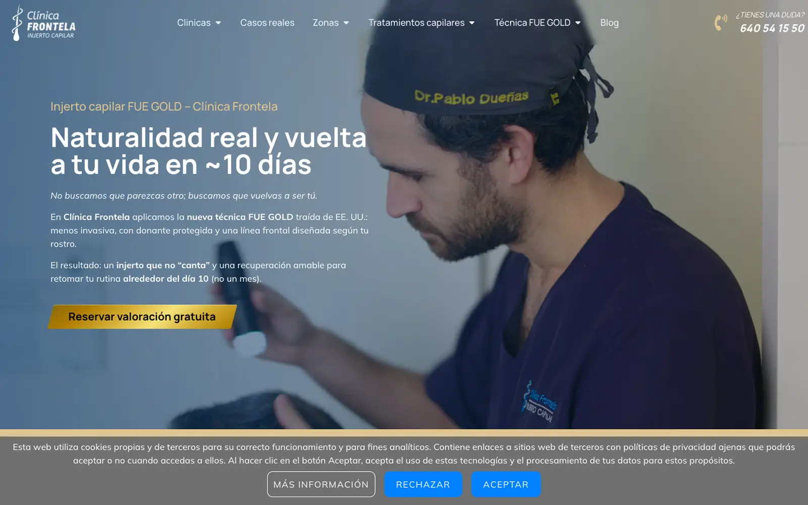 La web anterior de injerto capilar, antes de rehacerla.