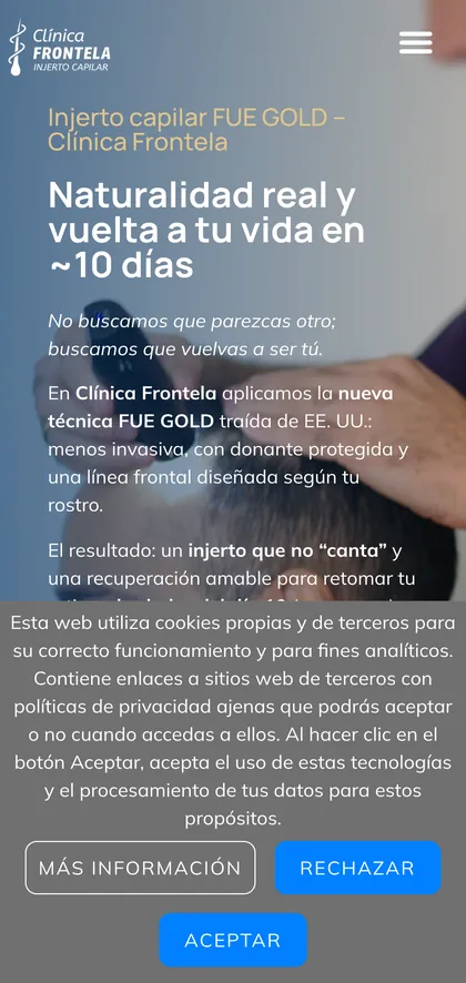 La web anterior de injerto capilar en el móvil.